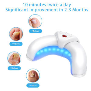 Nail Fungus Treatment for Multiple Toenail Painless Laser for Nail Fungus&Ingrown toenail Nail equipment