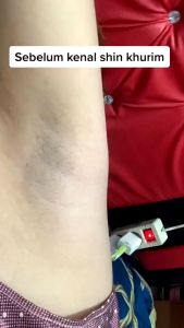 SHIN KURIM PEMUTIH KETIAK BPOM: Kelebihan & Cara Penggunaan