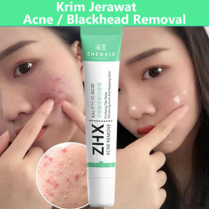 ZHENXIU Krim Anti Jerawat 20g: Memperbaiki Kulit dengan Cepat