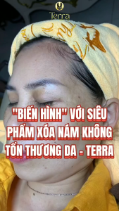 Tế bào gốcdịch chiết tế bàophục hồi da khi da mỏng yếu