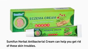 ORIGINAL & Effective Eczema Treatment herbal antibacterial cream 20g Safe and no side effects effective in one day psoriasis gamot sa buni ointment for itchy skin and allergy dermovate ringworm removal fungisol antifungal