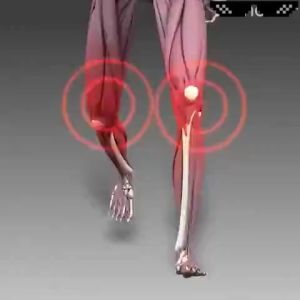 bee venom cream treatment gel Bone And Joint Care Soothing Relief of Joint Pain Arthritis ubat sakit lutut tambah gel