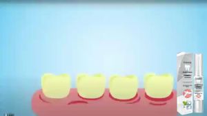 OUHOE Teeth Whitening Gel Pen White Teeth Cleaning Serum Oral Care Hygiene Essence Remove Stains Den