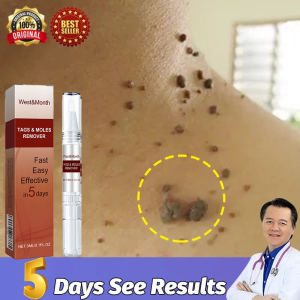Ubat ketuat Buang tahi lalat dan kutil Biji kolestrol remover wart removal liquid pen Skin Tag Moles Cholesterol Seed克疣祛痣膏