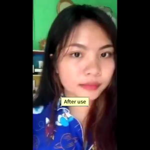 Acne Gel 30ml Obat Jerawat Wajah Perawatan Jerawat Efektif Wajah Spot Treatment Acne Obat Totol Jerawat Acne Treatment