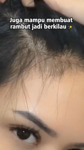 Penumbuh Rambut Yurizumi Red Ginseng Hair Tonic dan Mencegah Rontok 250 ml