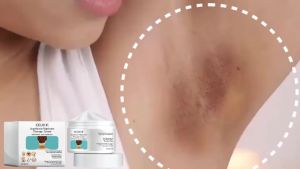 EELHOE | Acanthosis Nigricans Therapy Cream Elbow Joint Body Moisturizer Acanthosis Nigricans Improvement Dark Skin Cream