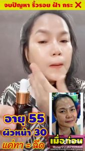 3 ขวด ของแท้💯 เซรั่มมายา ส่งฟรี‼️ เซรั่มโบท็อกซ์ MAYA Serum ครีมมายา #ครีมบำรุงผิวหน้า