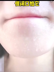 12 Cái / hộp Bong Bóng Anthocyanin Tẩy Tế Bào Chết Làm Sạch Thu Nhỏ Lỗ Chân Lông Mặt Dễ Dàng Vệ Sinh Chăm Sóc Da Mặt Mịn Tẩy Mụn Đầu Đen