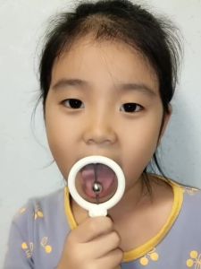 Chewing Tube Tips Speech Therapy Teeth Massager Talk Tools For Autism Sensory Speak Oral Muscle Rehabilitation Training
