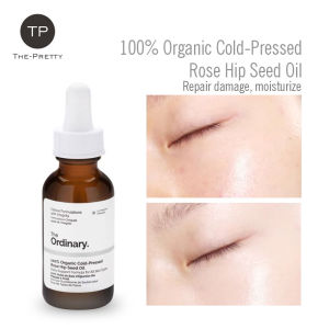 🔥Free Shipping🔥The Ordinary 100% Organic Cold-Pressed Rose Hip Seed Oil  Lines Correct Dark Spots Sun Spots and Uneven Skin Tone Fade Stretch  Marks 30ml[The Pretty]🔥Fast delivery&Ready Stock🔥
