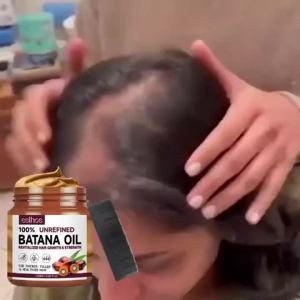 Organic Batana Oil for Hair Growth 100% Pure and Natural Batana Oil for Treating Hair Loss Anti-Breakage Hair