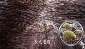 Amino Acid Sea Salt Dandruff Shampoo 500ml With Oil Control And Effective Dandruff Removal Long-Lasting And Fluffy