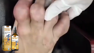 Ximonth  Bee Venom Body Care Spray   Relieve wrist and knee discomfort daily massage skincare spray