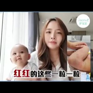 💎100%纯正椰子油💎【 Daionica Baby Oil 】2支 宝宝精华油 天然无刺激 有效解决 尿布疹 口水疹 湿疹 G6DP 热痱 不油不腻 皮肤太干 100%无色无味 无香精 5天明显改善宝宝肌肤敏感问题