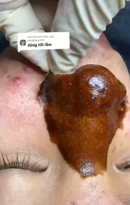 Gel lột mụn nha đam gel lột mụn than hoạt tính Catchy 200g - Tặng kèm nạ giấy lột mụn