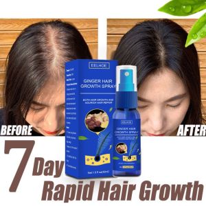 EELHOE Hair Growth Spray Penumbuh Rambut Wanita Pria Secara Cepat - Clothes Of Skin 7 Days Ginger Germinal Oil 30ml - Serum Rambut Rontok / Obat Penumbuh Rambut Botak Mirip Red Ginseng Hair Tonic Minyak Kemiri