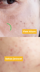 Reglow Intensive Whitening Night Cream | Menayamarkan Noda Hitam & Menjaga Kulit Tetap Terhidrasi dan Lembap Lebih Lama | Night Cream