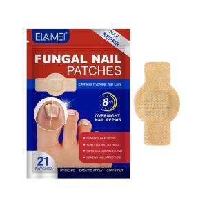 Grey toed nail fungus patch hydrogel improves infection fixation anti abscission and promotes new nail growth
