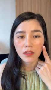 Kem mờ nám tàn nhang YAHERA Premium Cream Blur Melasma mờ nám tàn nhang chống lão hoá phục hồi da giảm nếp nhăn 30g