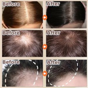 Ready Stock ginger anti hair loss shampoo hair growth herb plant penumbuh rambut gugur halia syampu 200ml生姜植萃防脱育发洗头水