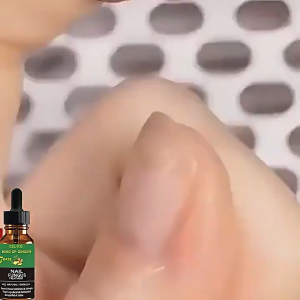 ผลิตภัณฑ์ดูแลเล็บ Liquid ขิงเล็บ Moisturizing Repair Essence การรักษาเชื้อราเล็บ การดูแลเชื้อราเล็บ หนังกำพร้า