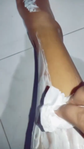 Dimples Hair Removal Cream Quick Gentle And Effective In 3 Minutes For Arms Legs And Bikini Line Effective Hair Removal Slows Down Hair Growth Suitable For Both Men And Women