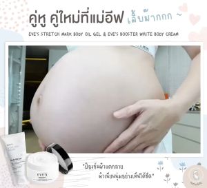 สินค้าขายดี Eves เซตคู่ ของแท้100% พร้อมส่ง ลดรอยแตกลาย รอยแผลเป็น จุดด่างดำ ฟื้นฟูผิว รอยแตกลายขาว แตกลายแดง อ่อนโยน  ไม่มีสารอันตราย คนท้องใช้ได
