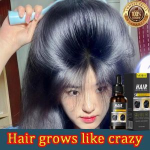 Ready stock Hair Growth Serum 30ml Hair serum Ginger Hair Growth Serum Essential Oils 生发精华 hair growth essential oil tonic Plant Essence Natural Hair Loss Herbal Anti Hair Loss【Authentic】