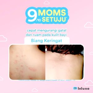 Loluna Cerapair Baby Rash Cream 30ml Krim Bayi Anak Anti Ruam Iritasi Ringan Gatal Gigitan Serangga