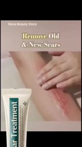 SADOER | Scar Removal Cream Repair Stretch Marks Burn Acne Surgical Acne Scar Ointment Herbal Treatment Gel Whitening Beauty Health Care