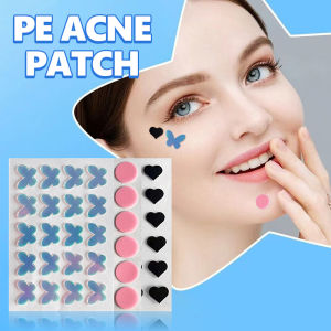 【COD】Patch Jerawat Berwarna-warni Tidak Beraturan Laser Film Biru Kupu-kupu Patch Jerawat -💞Margot