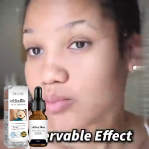 EELHOE Wart Removal Serum Esensi Penghilang Esensi Penghilang Kutil Mudah Dibawa Untuk Semua Kulit Esensi Penghilang Kutil