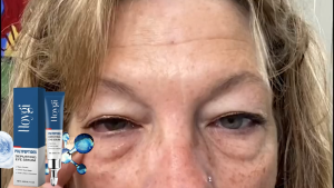 Hoygi Eye Essence Menyalamkan Lingkaran Gelap Melembabkan Kulit Kelebihan Mata 20g