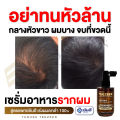 [Mid-Month] Yanhee Teezeer Anti Hair fall Serum [ของแท้] เซรั่มบำรุงผม ยันฮี ทีเซอร์ เซรั่มบำรุงหนังศรีษะ เซรั่มผม ยันฮีผมร่วง บำรุงผมเสีย ผมดกหนา (60ml/ขวด) ส่งฟรี GlowWell. 