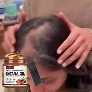 EELHOE | 100% Pure Organic Hair Mask Batana Oil Hair Growth Oil Natural Treatment Nourish Reduce Hair Loss Anti-Breakage Hair Conditioner
