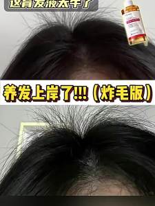 ORGINESE | Anti-Hair Loss Growth Enhancer Solution
