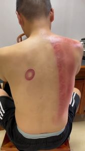 COD GARANSI - Alat Kerok Bekam Badan Massager Alat Kerik Elektrik Scraping Massage Plus