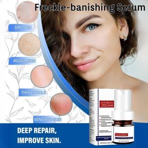 Freckle-banishing Serum For Face Repair And Cleanse Dark Spots Lightening Acne Dark Patches Skincare
