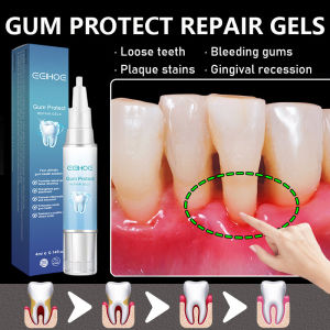 Gum Repair Gel Gum Instant Soothing Gel Receding Gums Tooth loosening