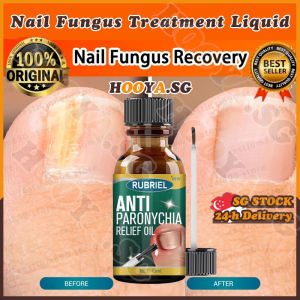 ✅SG stock✅ Nail fungus treatment liquid / Nail repair serum / Anti paronychia relief oil Ingrown toenail treatment / 甲沟炎