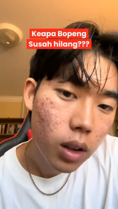 Dr. Fay Serum Pembersih Wajah Aroma Woody & Earthy dengan Vitamin C dan E - Bebas Paraben untuk Kulit Kombinasi