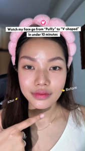 NANO SKINZ Cryo Thermal Pro | 6-in-1 Hot Cold LED Light RF EMS Face Device | Massage Derma Shot Booster Pro Facial Skin | For Glow Slimming Uneven Skin Tone Pore Control