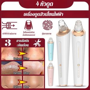ประสบการณ์ที่สะดวกสบาย เครื่องวัดรูขุมขน เครื่องวัดความสะอาดของผิว ลบสิวและสิวหัวดํา วัสดุเพื่อสุขภาพ ปรับปรุงสภาพผิว