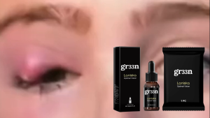 Eyesight Improvement Eye Drops Presbyopia Myopia Relieve Eyes Fatigue Discomfort Dry Itching Redness Blurred Vision Moisturizing