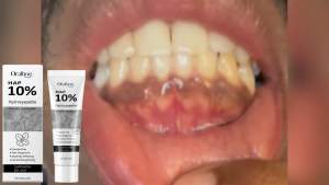 Oralhoe ยาสีฟันฟื้นฟูฟันขาว HAP 10% Hydroxyapatite Toothpaste ยาสีฟันป้องกันกลิ่นปาก ลมหายใจสดชื่น ขจัดคราบฟัน ขจัดหินปูน ลดกลิ่นปาก ลดหินปูนและฟันเหลือง ช่วยให้ฟันขาวขึ้นแบบธรรมชาติ ยาสีฟันฟันขาว ยาสีฟันไวท์เทนนิ่ง