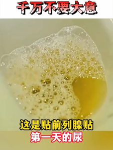 Prostate Patch - Urinary frequency urgency difficulty urinating and prostate pain. 5 patches/1BOX 前列腺贴片-尿频、尿急、排尿困难和前列腺疼痛