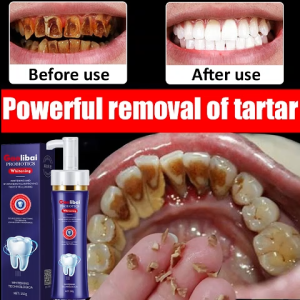 Whitening toothpaste Whitening and stain removal toothpaste Aromatic menthol whitening toothpaste Reduces yellowing of teeth Removes tartar Freshens breath Maintains oral health