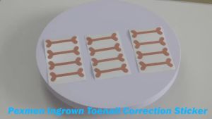 Pexmen 4/8Pcs Ingrown Toenail Sticker Adhesive Toe Nail Patch Foot Care Tool