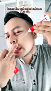 【COD】CHALONESE Niacinamide Skin Cream / Salep Pemutih Efektif Penghilang Flek Bintik Hitam / Jerawat / Whitening Freckle Cream Remove Dark Spots